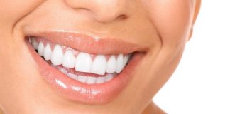 Time to reach your oral aesthetic with veneers